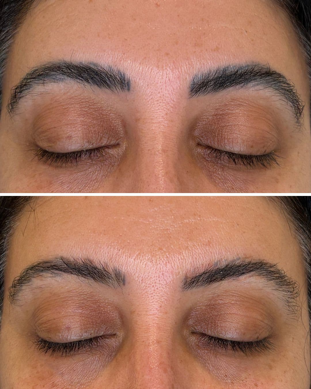 Before and after of permanent makeup brow removal showing significant fading after one laser session at Studio Kiku