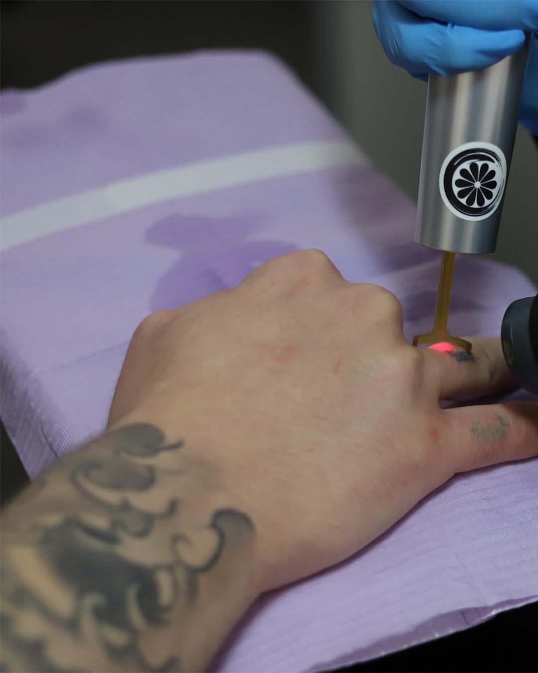 Close-up of the Studio Kiku laser handpiece treating a hand tattoo, with the aiming beam visible