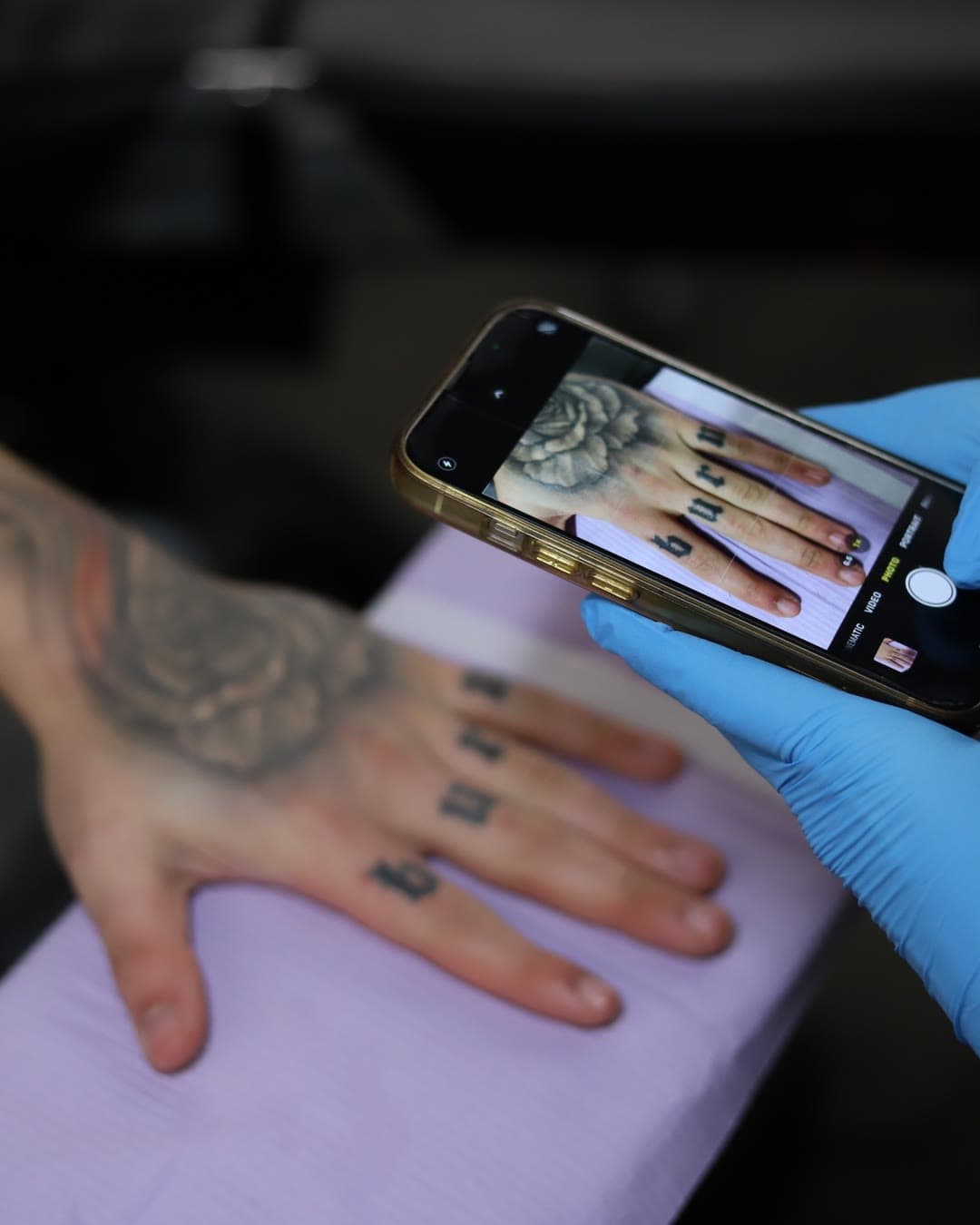 Studio Kiku technician in blue gloves documenting a client's tattooed hand with a phone before a laser tattoo removal session