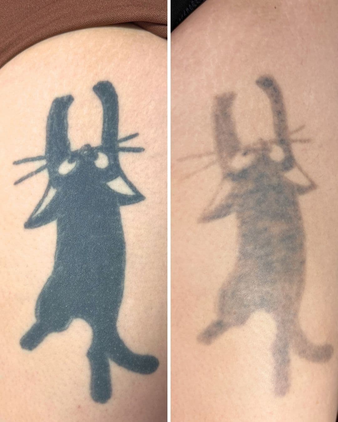 Side-by-side photos of a solid black cat tattoo on an upper arm, the right image showing it much lighter and mottled after six sessions of PicoWay laser removal at Studio Kiku