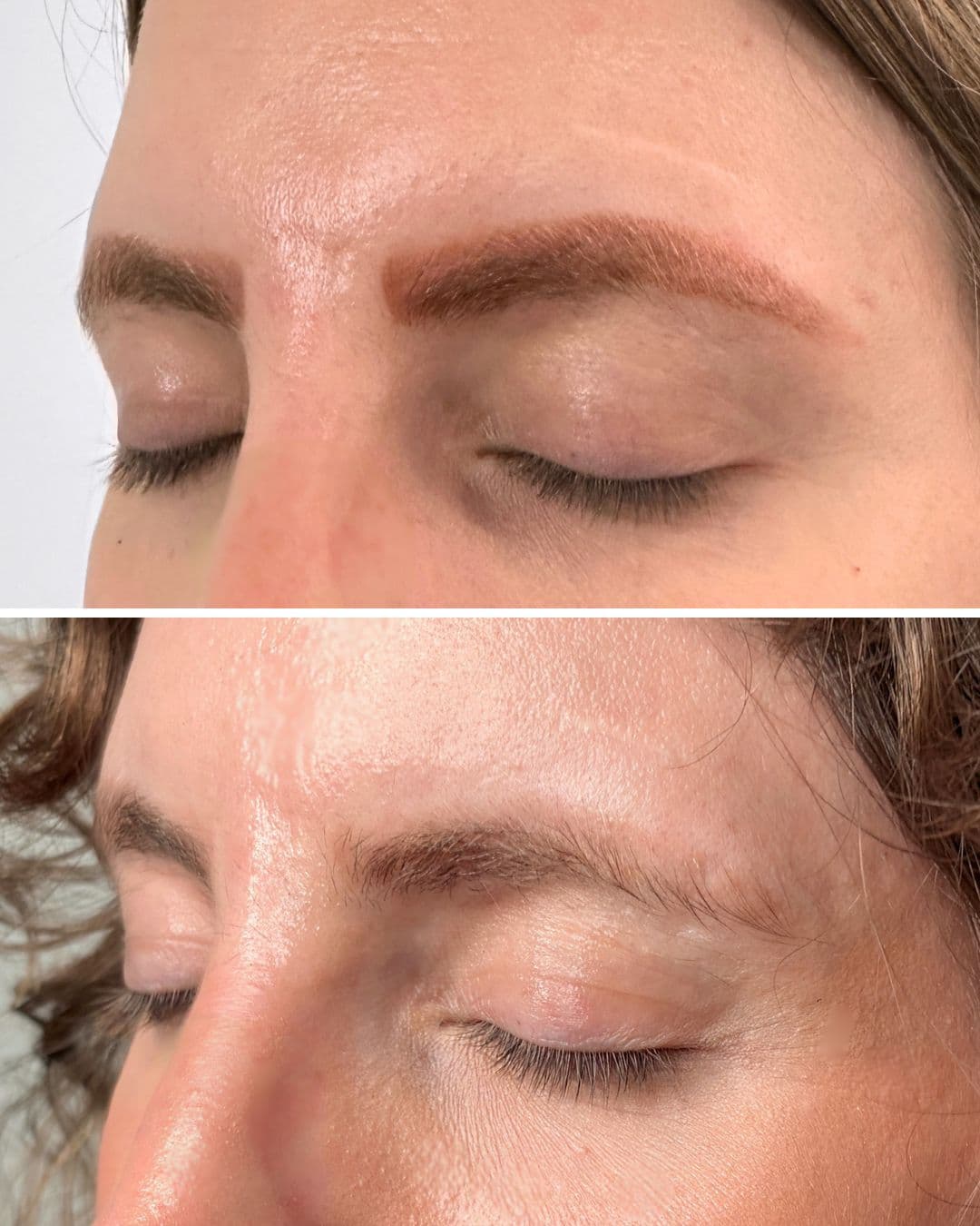 Before and after of permanent makeup brow removal at Studio Kiku, with only a faint trace of pigment left after four laser sessions