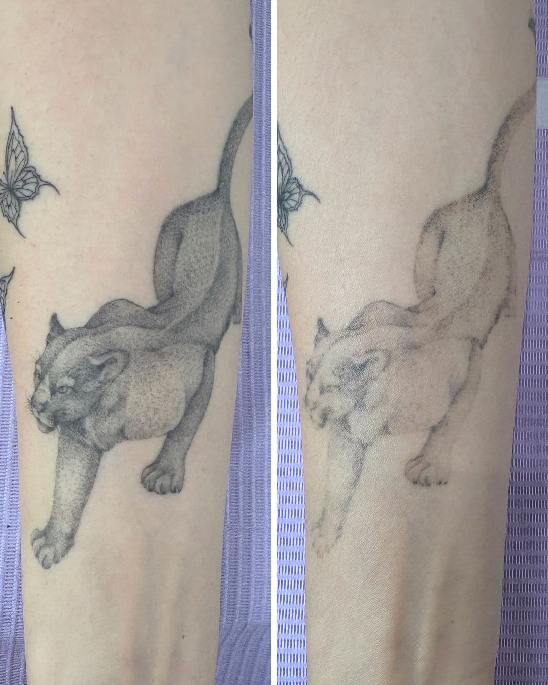 Side by side comparison of a fine line black and grey cat tattoo on a forearm, before and after one PicoWay laser removal session, with the stippled shading noticeably lighter