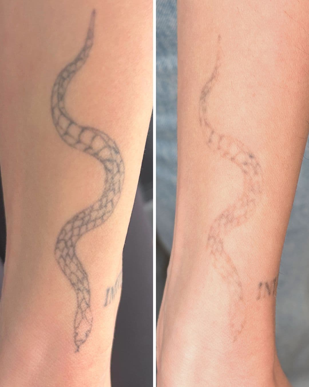 Before-and-after comparison of a black snake outline tattoo on a forearm showing dramatic fading after two laser sessions at Studio Kiku