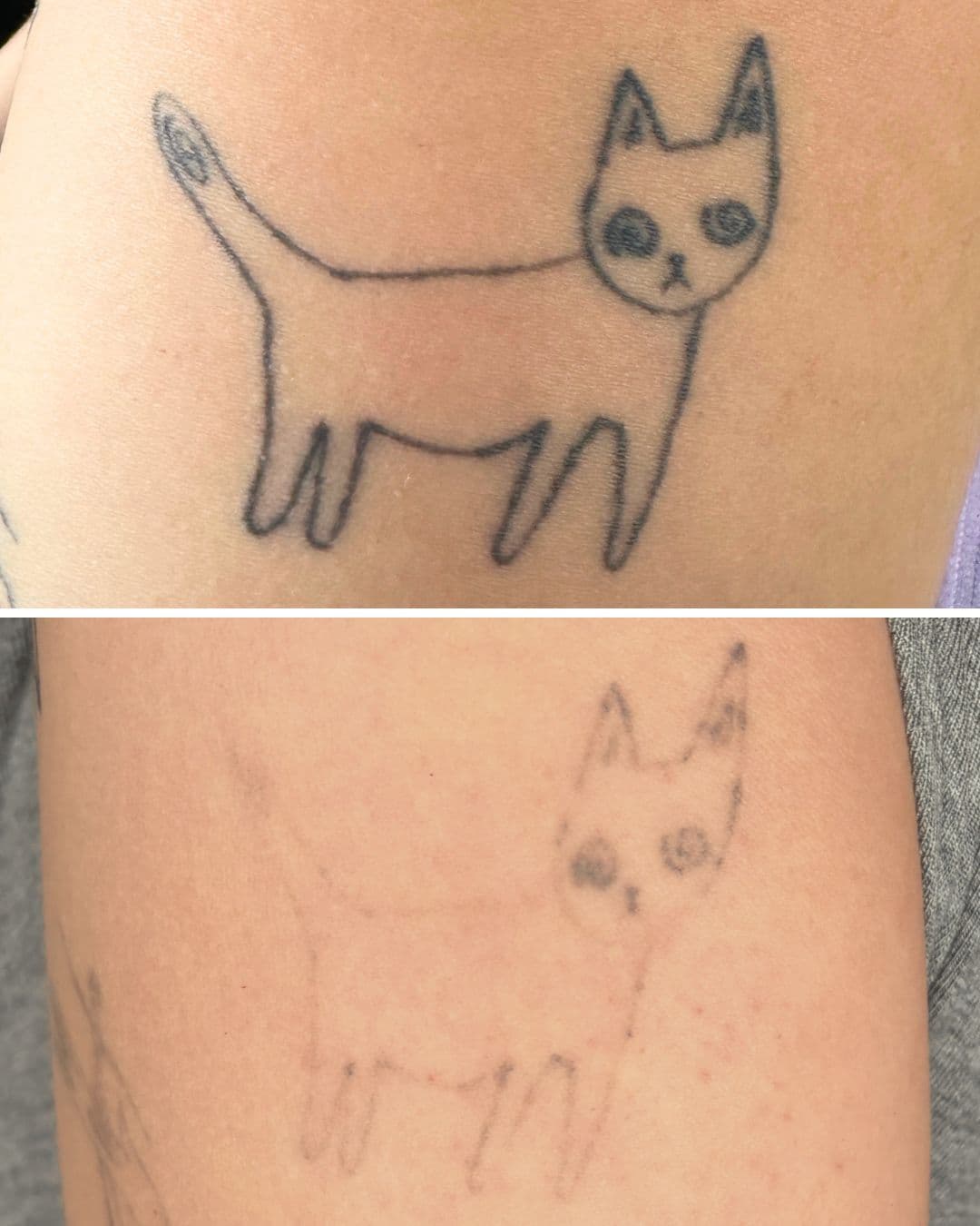 Before and after showing a simple line-art cat tattoo on an arm nearly faded after 3 sessions of laser tattoo removal at Studio Kiku