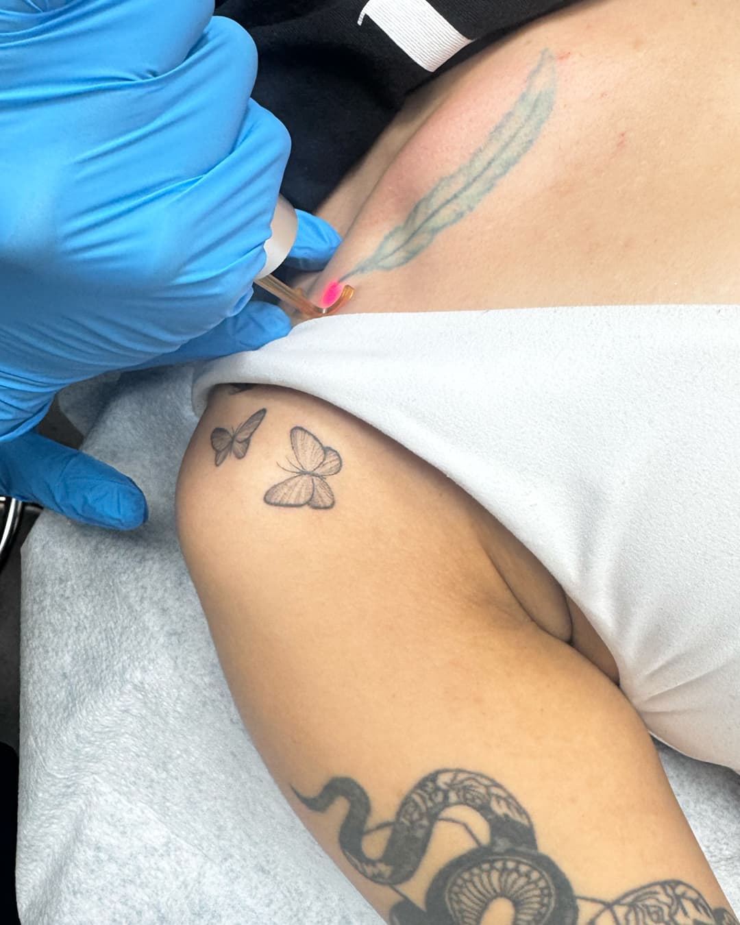 Studio Kiku technician applying the PicoWay laser handpiece to a fading feather tattoo during a removal session