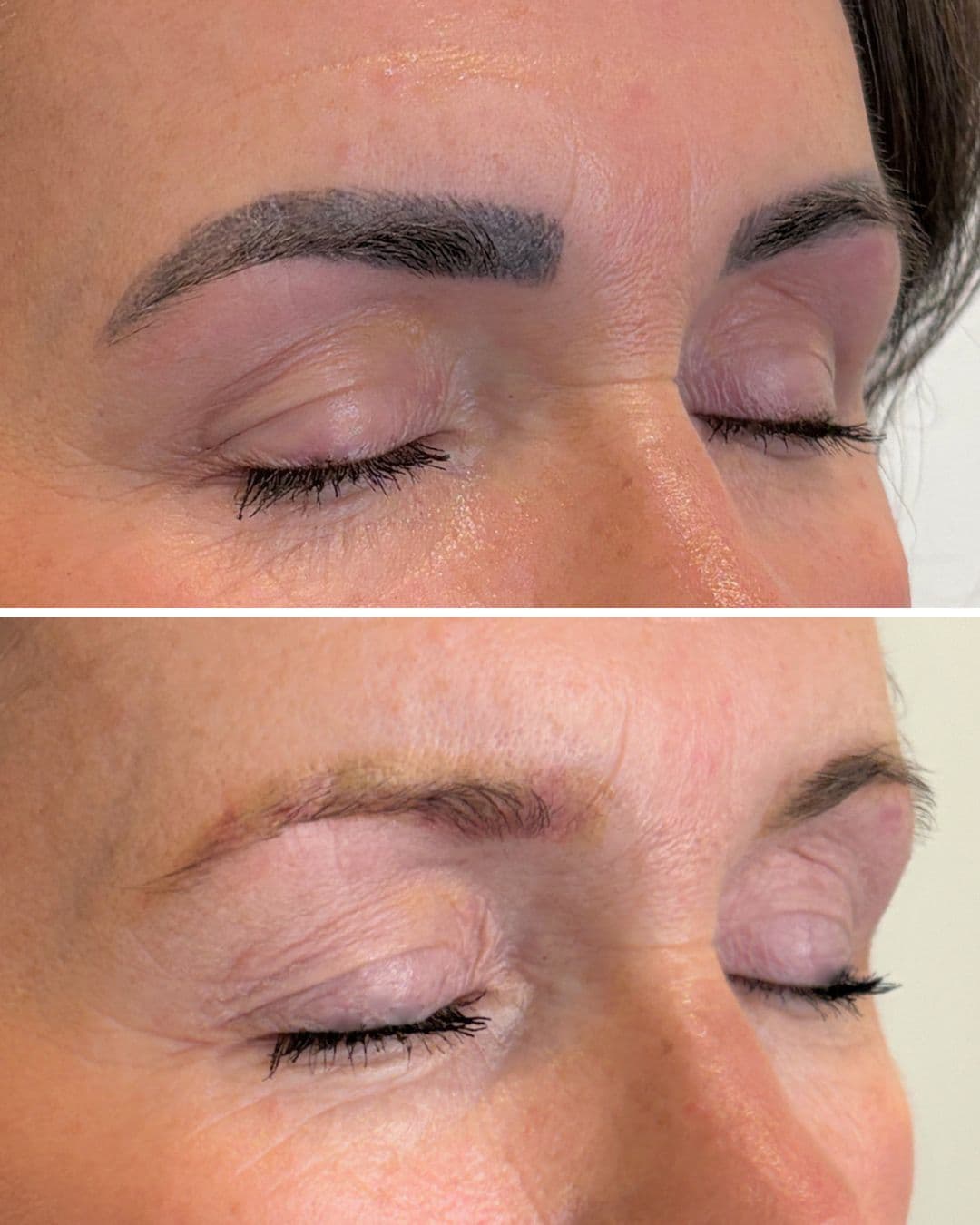 Before and after of permanent makeup brow removal showing significant fading after two laser sessions at Studio Kiku