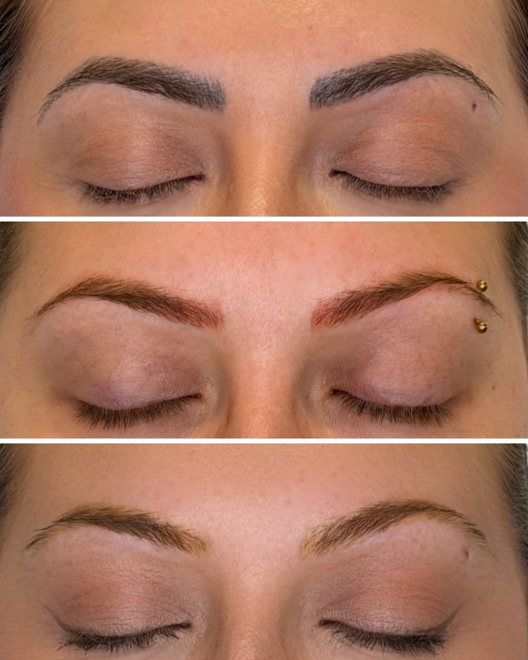 Three-panel before and after showing PMU brow removal progression over two laser sessions, from dark microbladed brows to noticeably lighter, more natural brows.