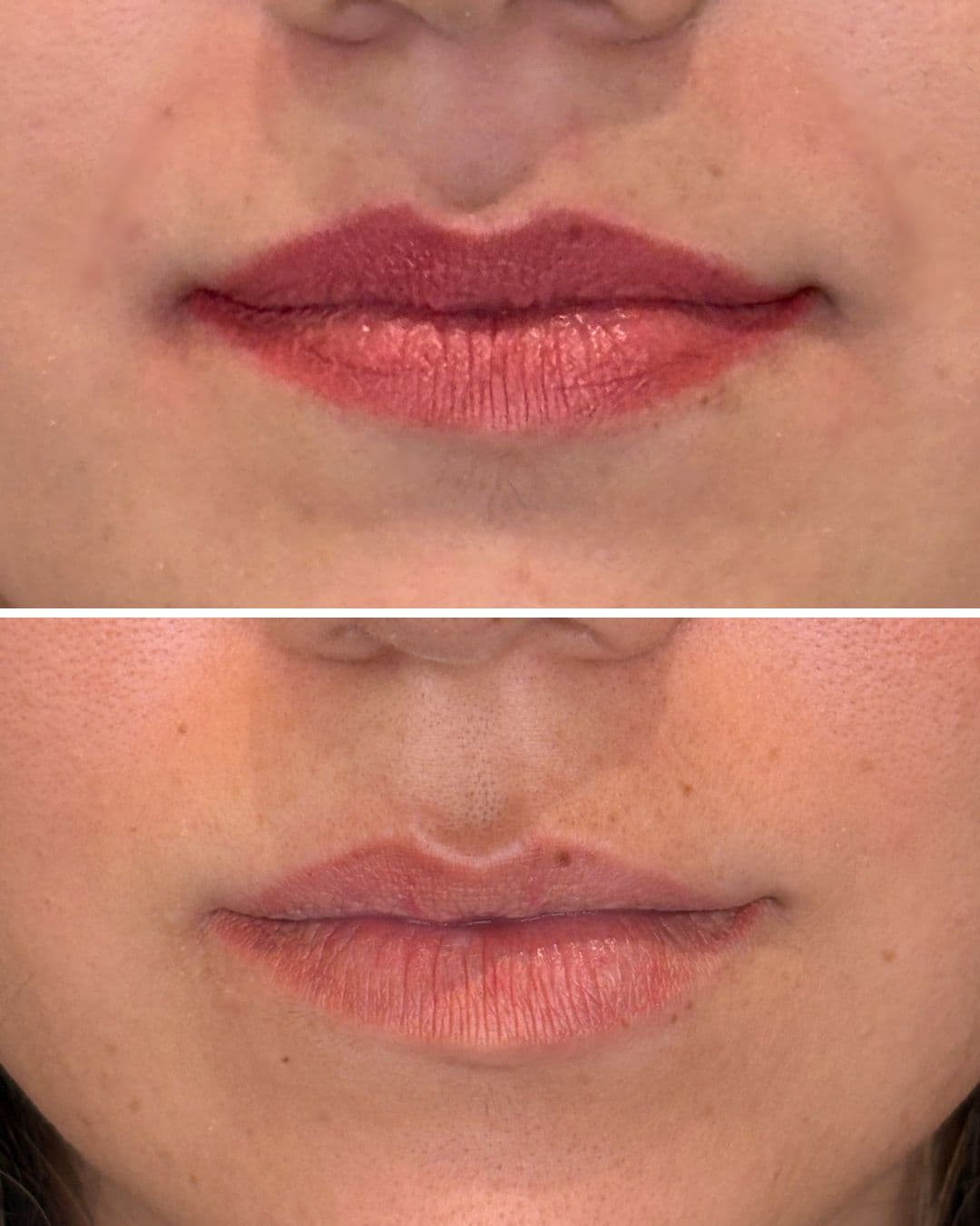 Before and after showing significant lip blush fading after one laser session at Studio Kiku, from deep pink saturated pigment to near-natural lips