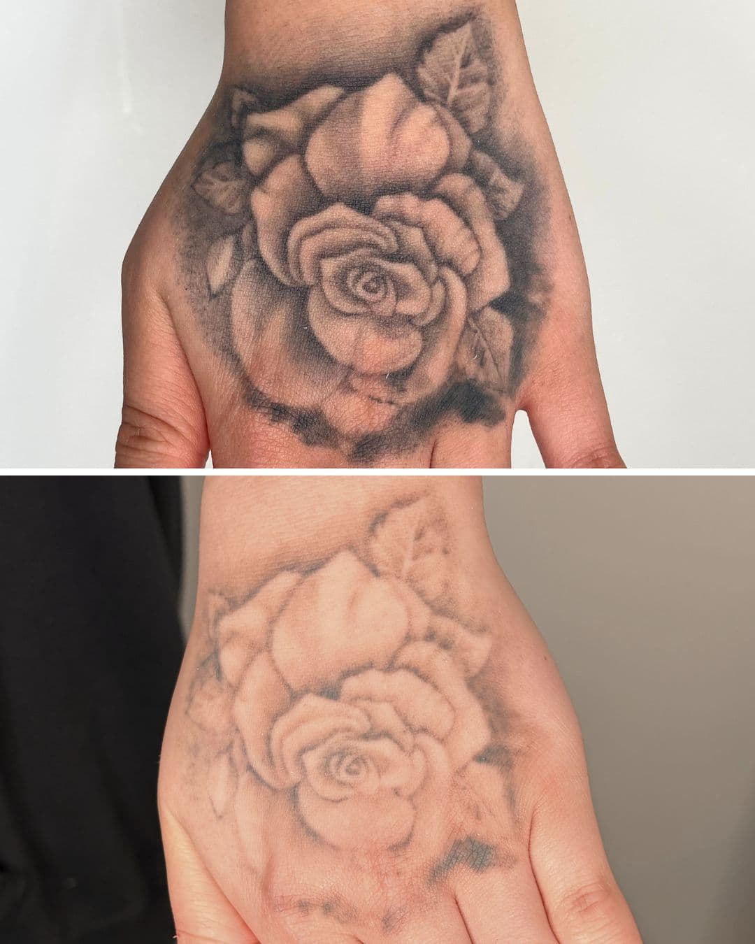 Before and after of a black and grey rose tattoo covering the back of a hand, the second image showing the shading substantially lightened after three sessions of laser removal at Studio Kiku