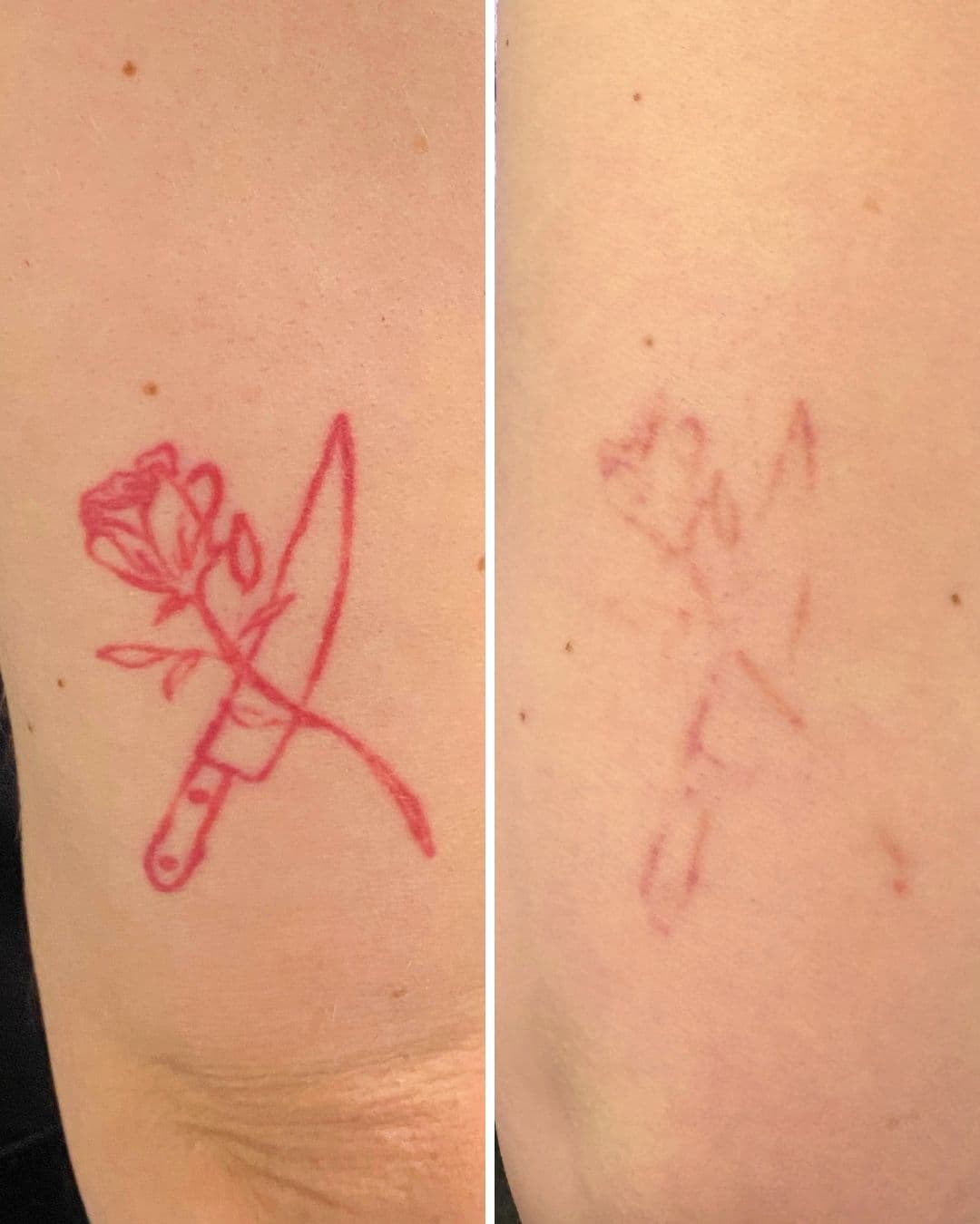 Before and after of a red rose and knife tattoo after one laser tattoo removal session at Studio Kiku, showing significant fading with clean surrounding skin and no pigmentation changes