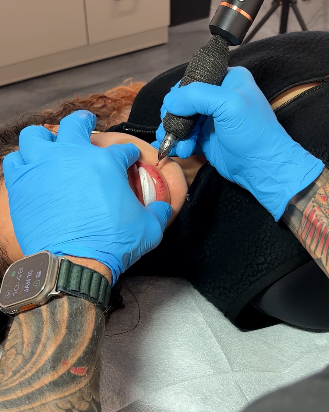 Saline removal of lip blush pigment in progress at Studio Kiku