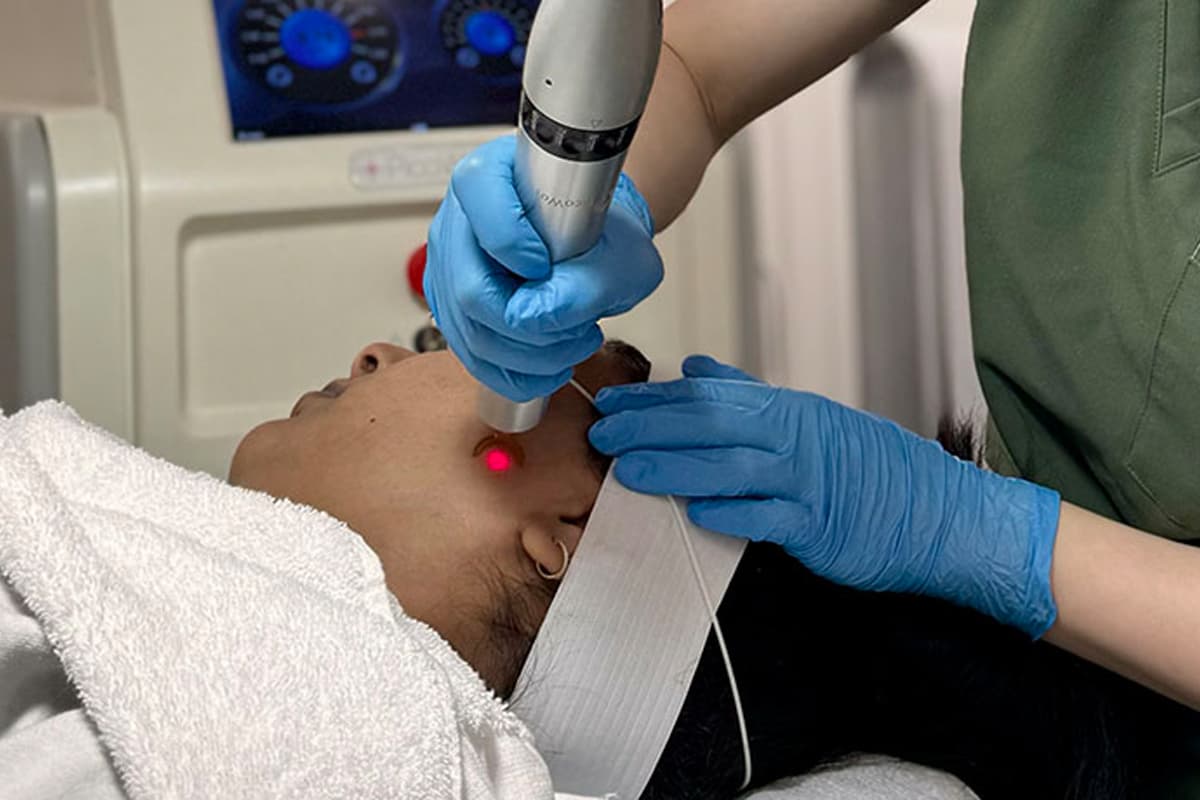 PicoWay laser facial treatment at Studio Kiku