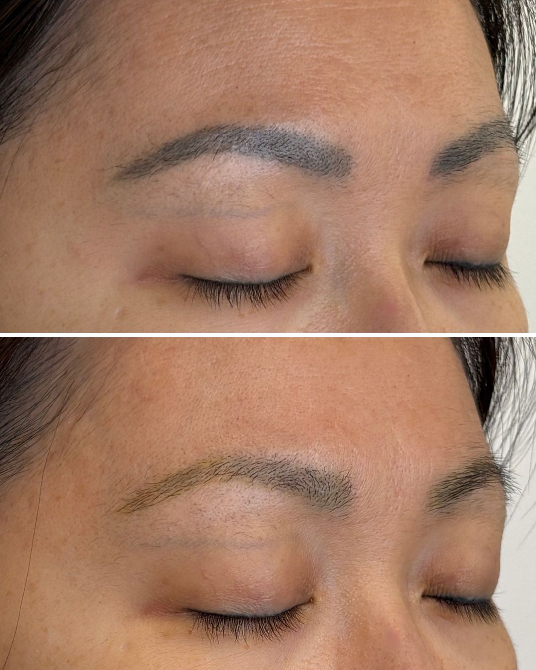 PMU brow removal — 1 session