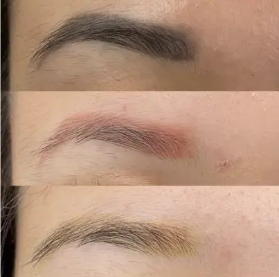Learn about the PMU brow removal process and why pigment will change colours