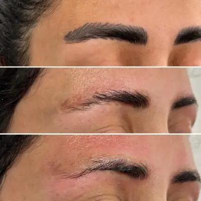 pmu-removal-before-after