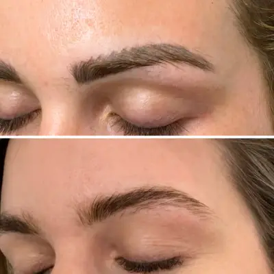 microblading tattoo removal results