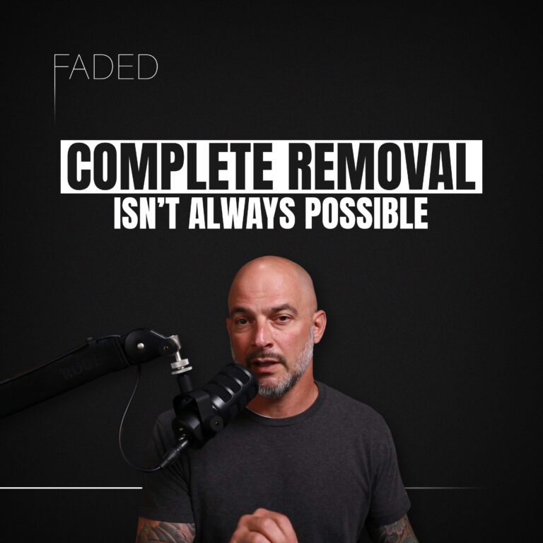 Faded Podcast EP01 Laser Tattoo Removal