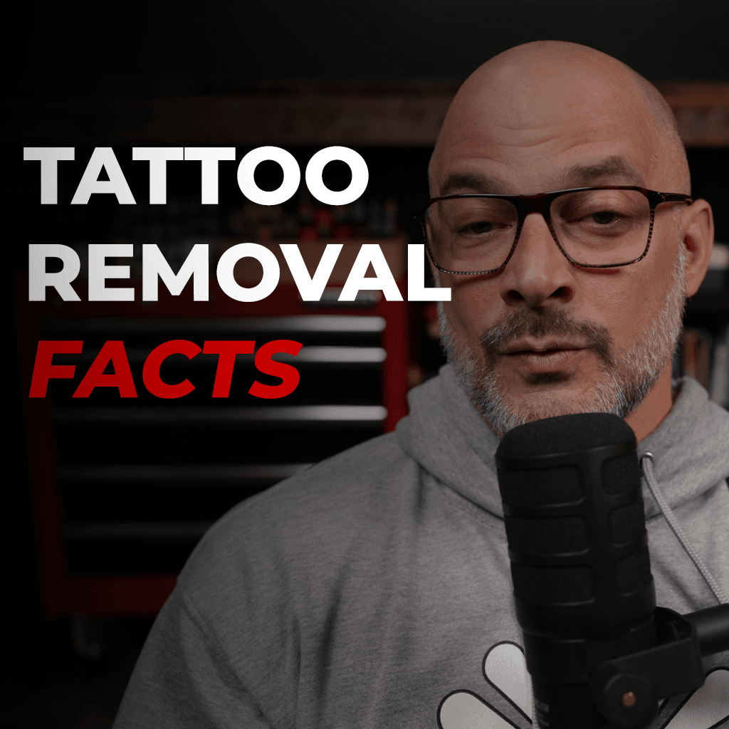 Laser Tattoo Removal facts