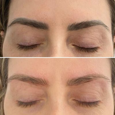 Nanobrows in Vancouver, cost, advantages and aftercare